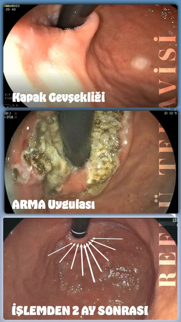 ARMA işlemi yaptıranlar